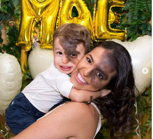 The son was very shy of his birthmark. Then mom decided to show him in an original way that he is unique