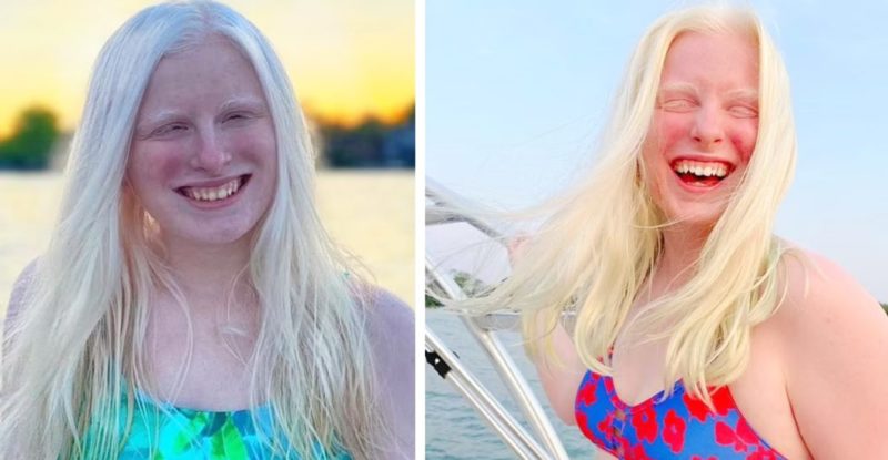 Nature has no limits in its creativity. This girl's eyes confirm it