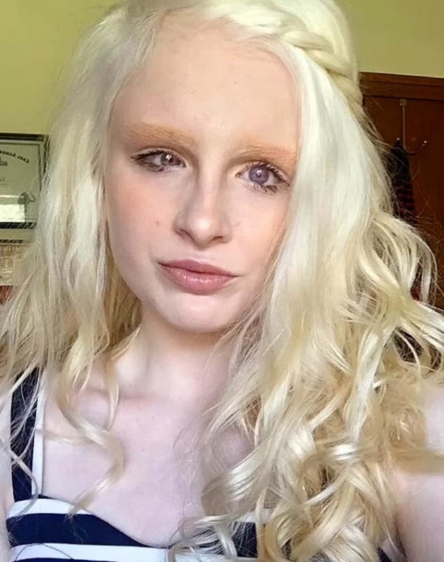 Nature has no limits in its creativity. This girl's eyes confirm it