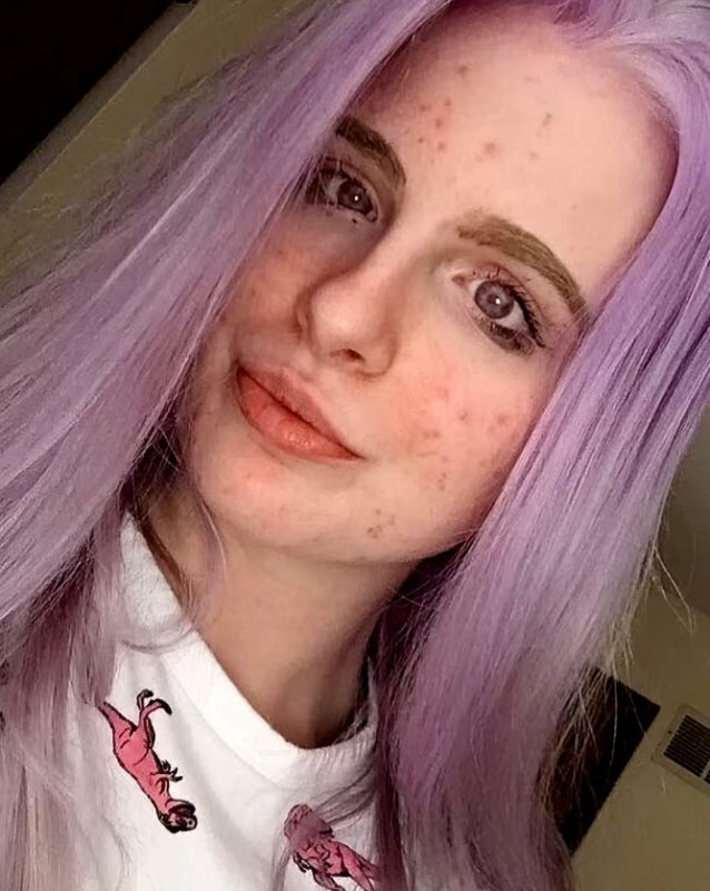 Nature has no limits in its creativity. This girl's eyes confirm it