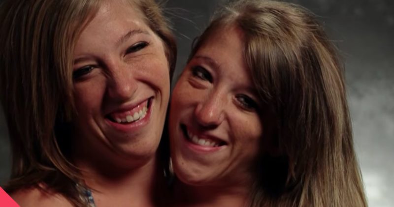 They were one: this is what happened to the Siamese sisters, which almost everyone heard about