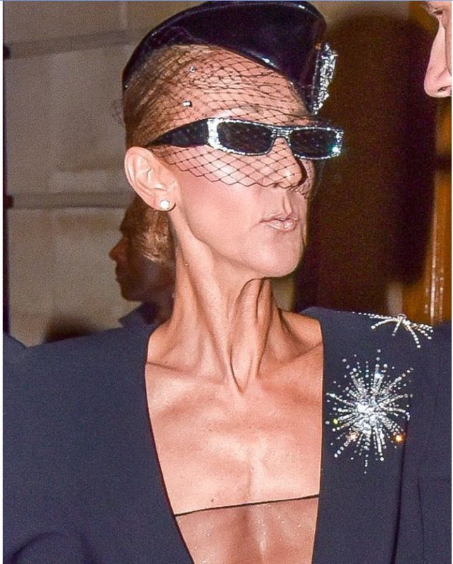 54 yearold emасiated and very thin Celine caused fear among fans