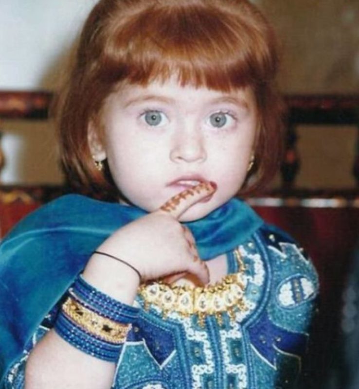 In childhood, she was pushed out because of the unusual appearance. How does it look like