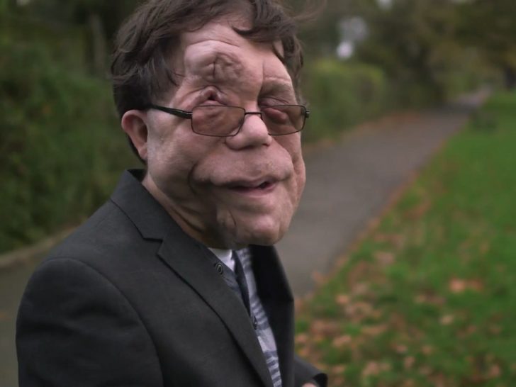 The story of Adam pearson, who refused to spend his life suffering and instead chooses to inspire millions of viewers through his work