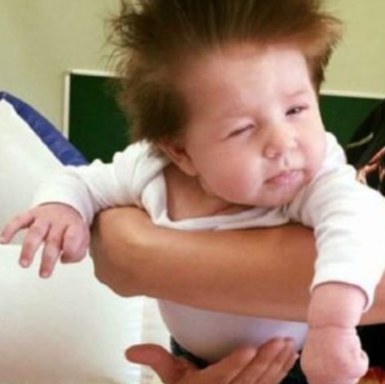 Obstetricians were particularly taken aback by these boys: the lady gives birth to two unique sons