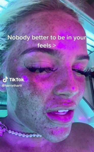 A fan of the solarium showed her face up close, after these photos you will no longer want to sunbathe