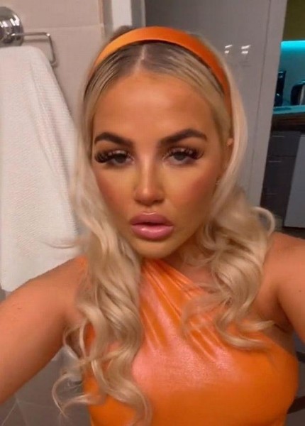 A fan of the solarium showed her face up close, after these photos you will no longer want to sunbathe