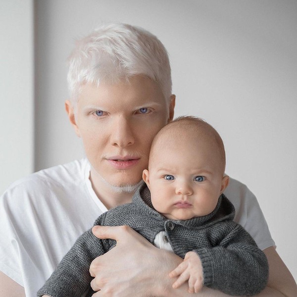 Just an angel: what does a child of a Georgian model and the most beautiful albino in the world look like