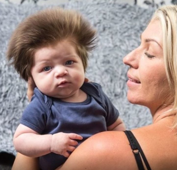 That cute kid with the thick hair. How the young man who ruled the Internet a few years ago appears today