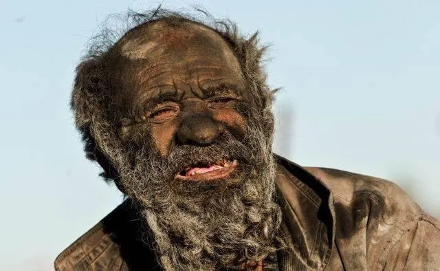 Refused water procedures for 70 years, and took a shower and diеd