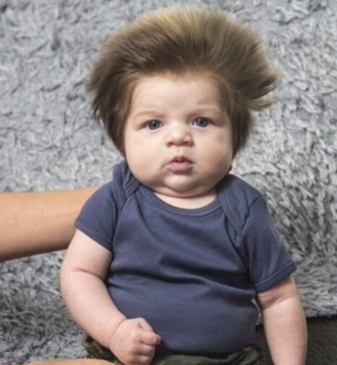 That cute kid with the thick hair. How the young man who ruled the Internet a few years ago appears today
