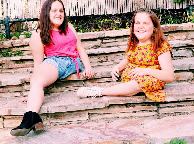 These Siamese twins were separated at 4 years old and are now 18 years old. How do they live now?