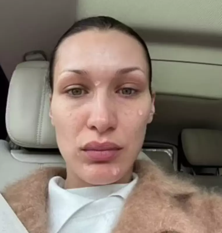 My face is changing! Bella admitted that because of the disease she hated mirrors
