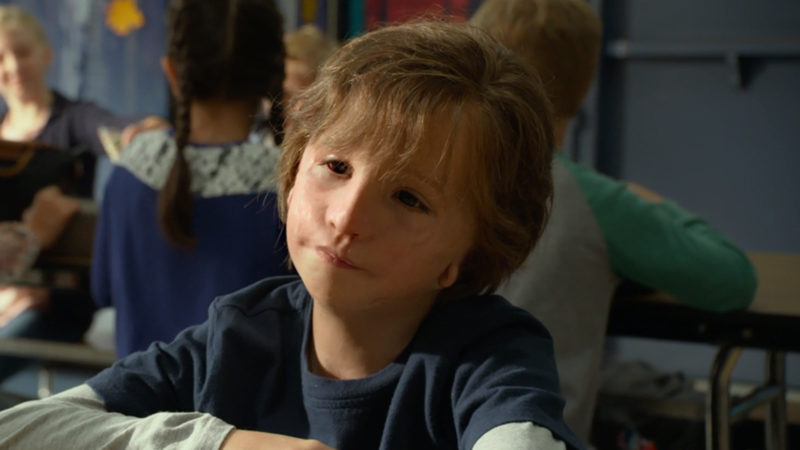 You can’t recognize without makeup! this is how the ugly boy from the movie Miracle grew up