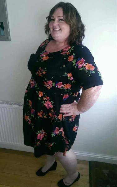 She looks 60 at 30! Overweight has become a real problem for this girl
