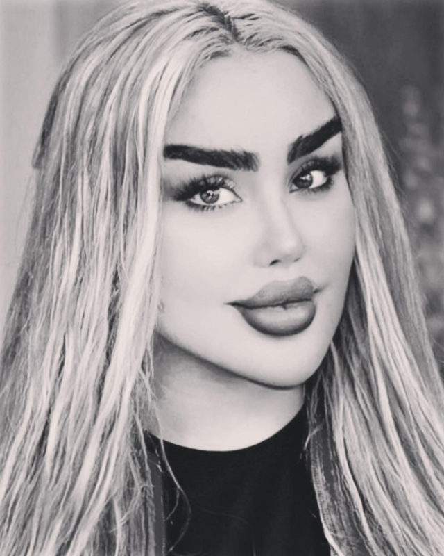 Several dozen surgeries did not make Barbie out of her! Girl in despair