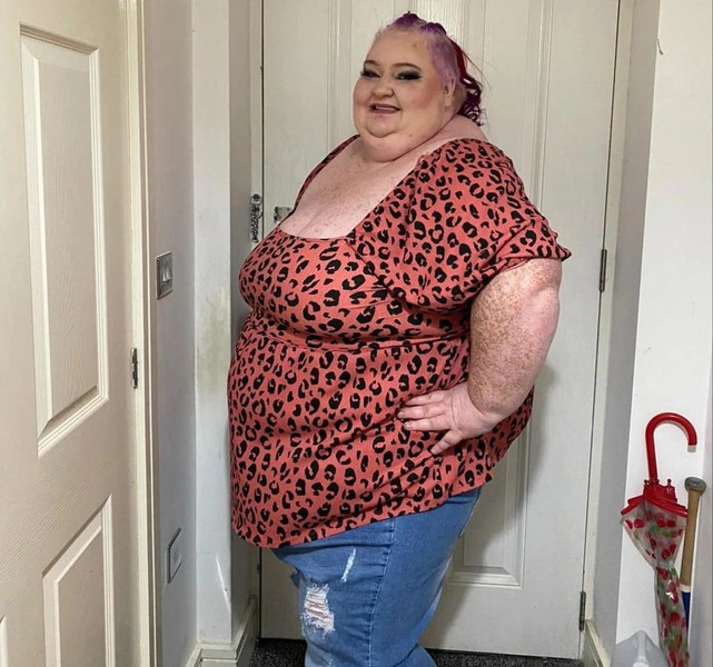 She looks 60 at 30! Overweight has become a real problem for this girl