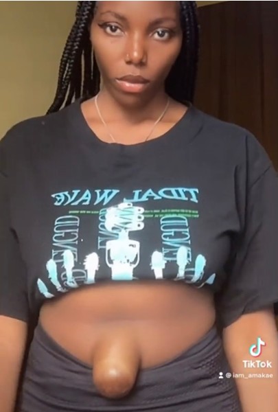 What does a girl with the ugliest belly button in the world look like! These photos are not for the faint of heart