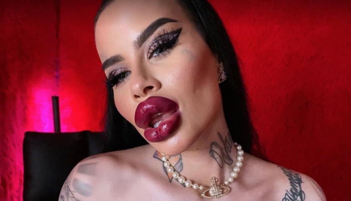 What does a girl look like who enlarged her lips 60 times! after these photos you are unlikely to go to the beautician