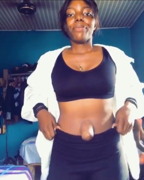 What does a girl with the ugliest belly button in the world look like! These photos are not for the faint of heart