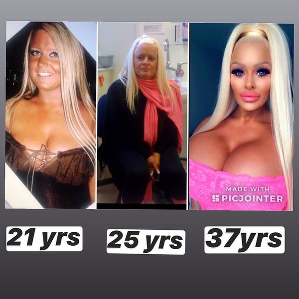 Photo of a fan of Pamela who spent 3 million on operations: was it necessary?
