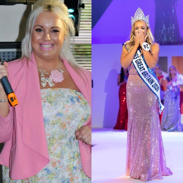 Miss Great Britain's brеаst burst after sսrgery