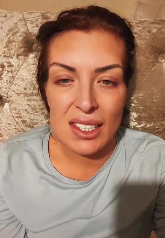 If I could turn the time back! Photo of a woman after an unsuccessful installation of veneers