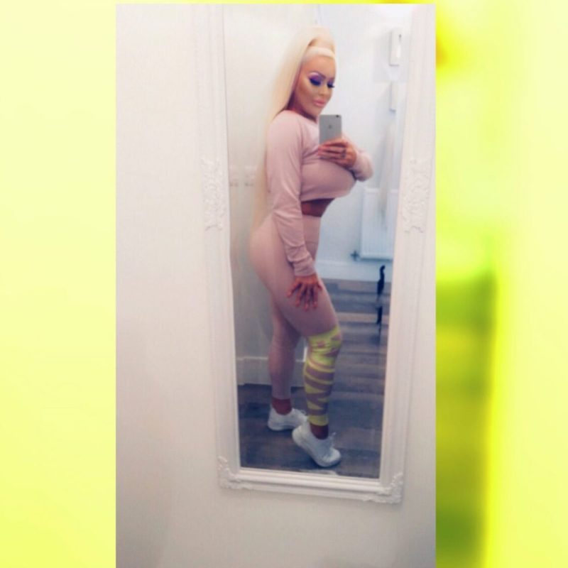 Photo of a fan of Pamela who spent 3 million on operations: was it necessary?