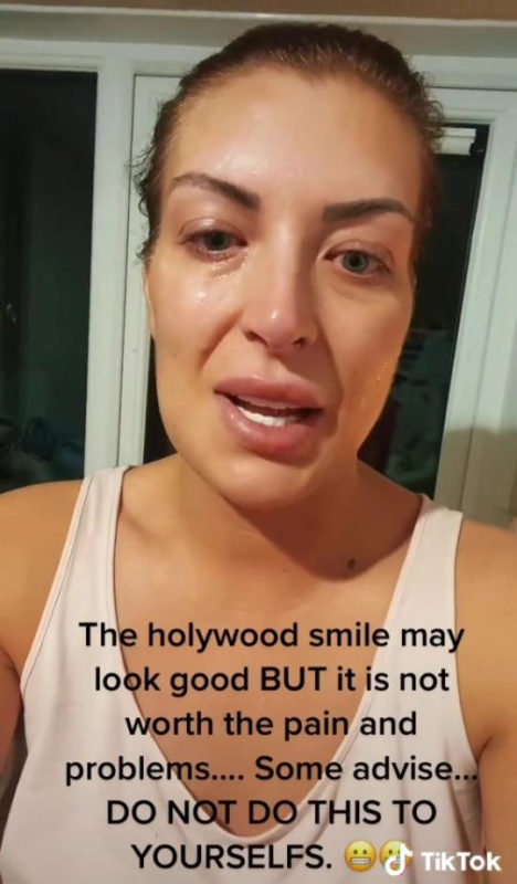 If I could turn the time back! Photo of a woman after an unsuccessful installation of veneers