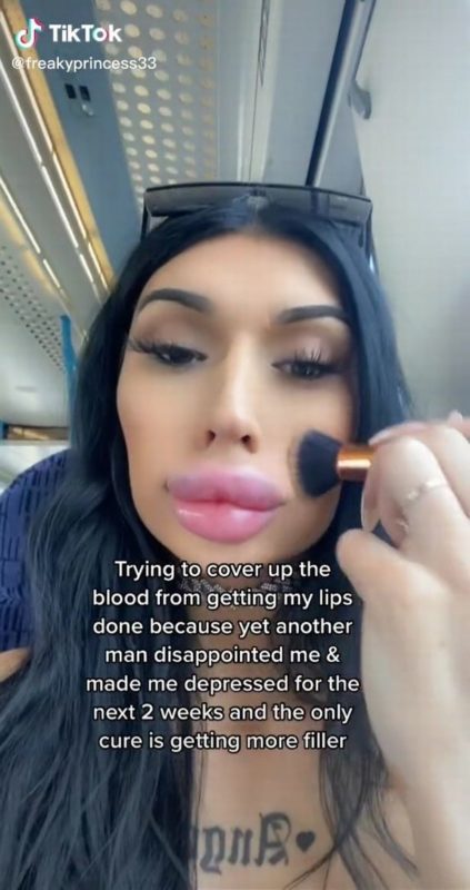 I could hide it with a mask! What does a girl with fish lips look like?