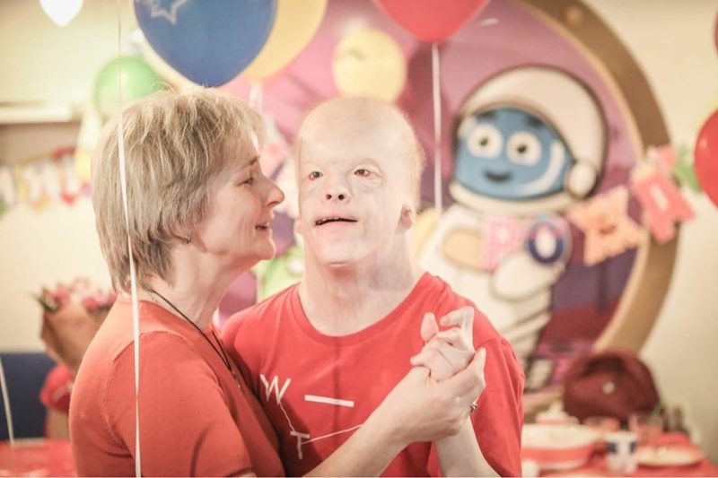 Alien visitor: how an 18 yearold boy with rare disease looks and lives