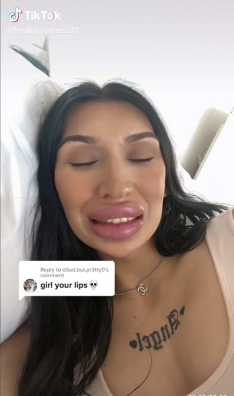Will burst soon! photo of a girl who increases her lips after every breakup
