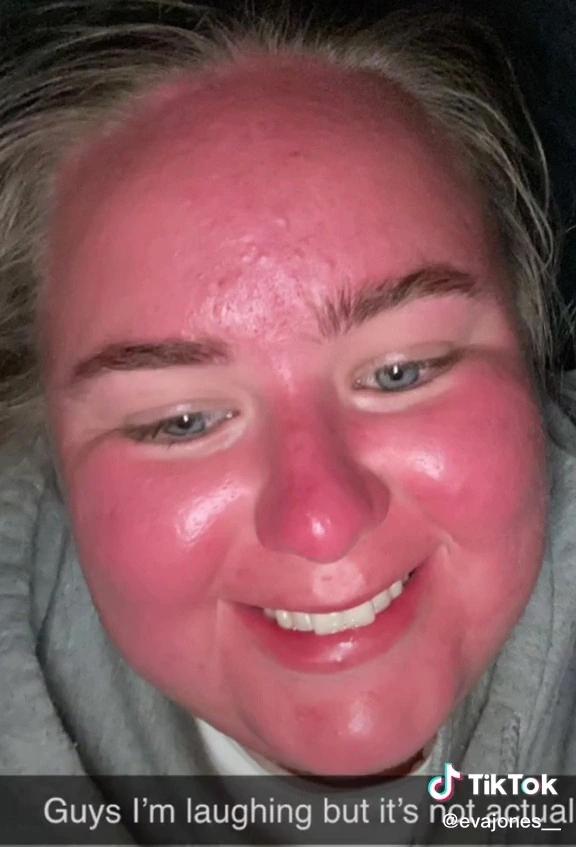 How an hour in the sun changed a woman's face beyond recognition