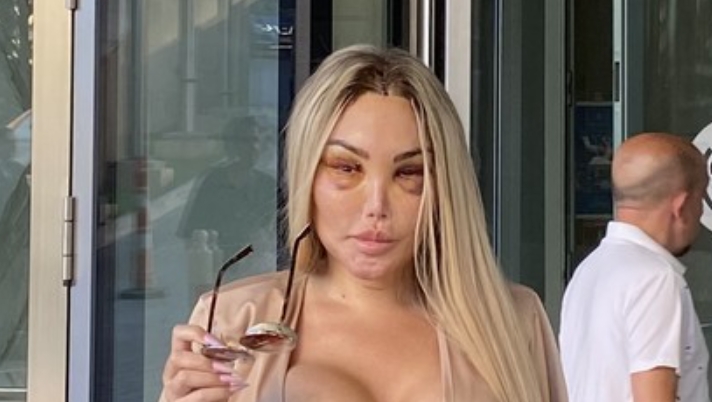 Due to a plastic surgeon's mistake, the living Ken can't leave the house! Creepy photos