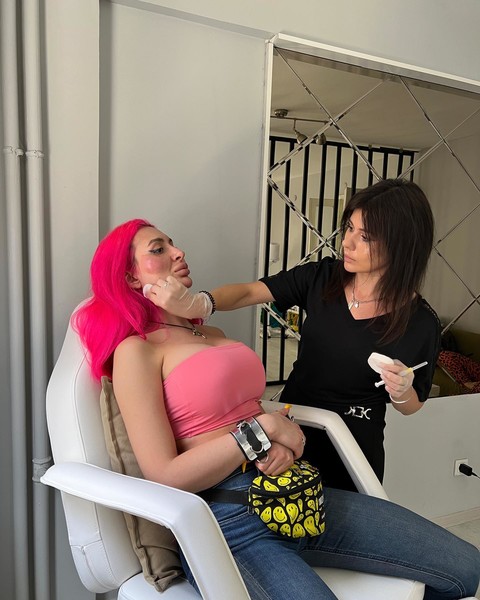 She can't stop! The model injects fillers in the cheeks and they will soon burst