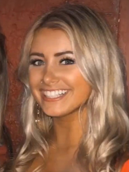 23 yearold American woman enlarged her lips, and they became eight times larger
