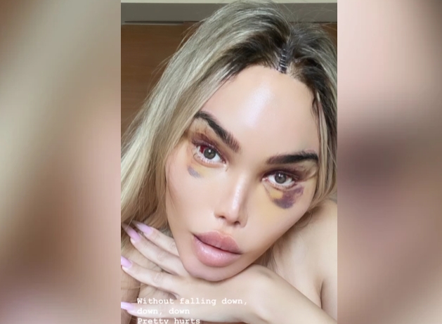 Due to a plastic surgeon's mistake, the living Ken can't leave the house! Creepy photos