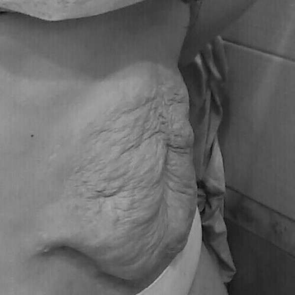 The belly is disfigured irrevocably! Photos of women who gave birth to twins