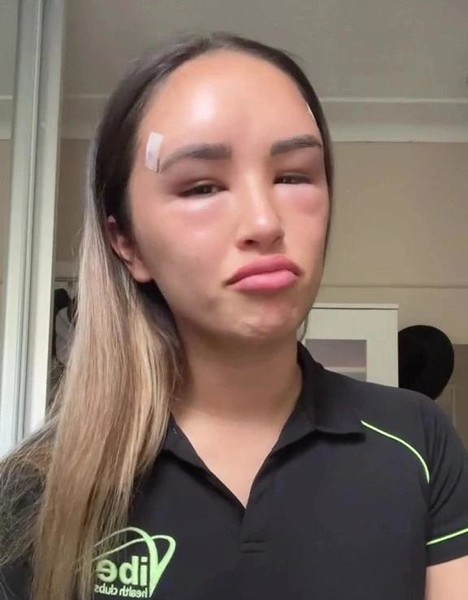 The girl made fox eyes, but then she wanted to return everything back and turned into a ball