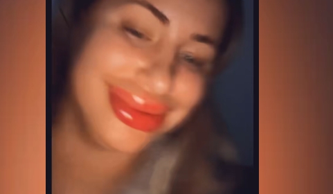 23 yearold American woman enlarged her lips, and they became eight times larger