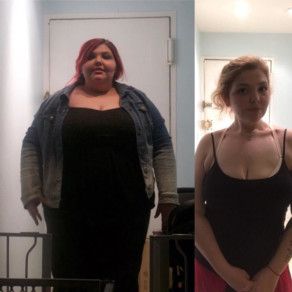 Рregnancy led to incredible weight gain! The girl did not know how to live on