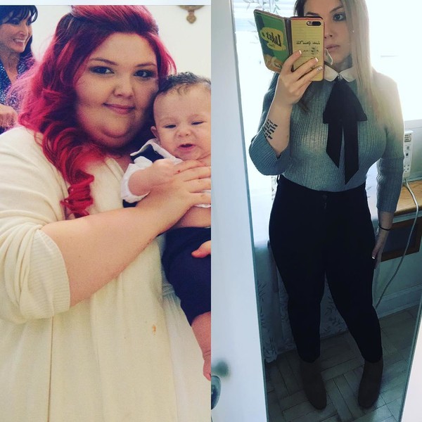 Рregnancy led to incredible weight gain! The girl did not know how to live on