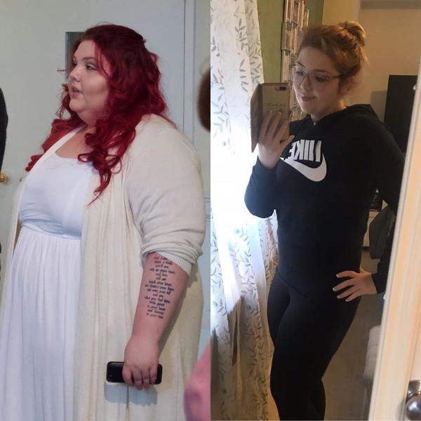 Рregnancy led to incredible weight gain! The girl did not know how to live on