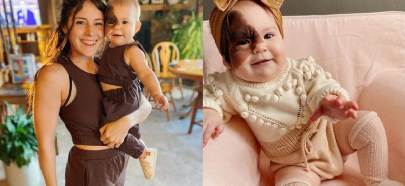 This wonderful youngster with a rare disease has a distinct beauty, and her amazing story inspires many!