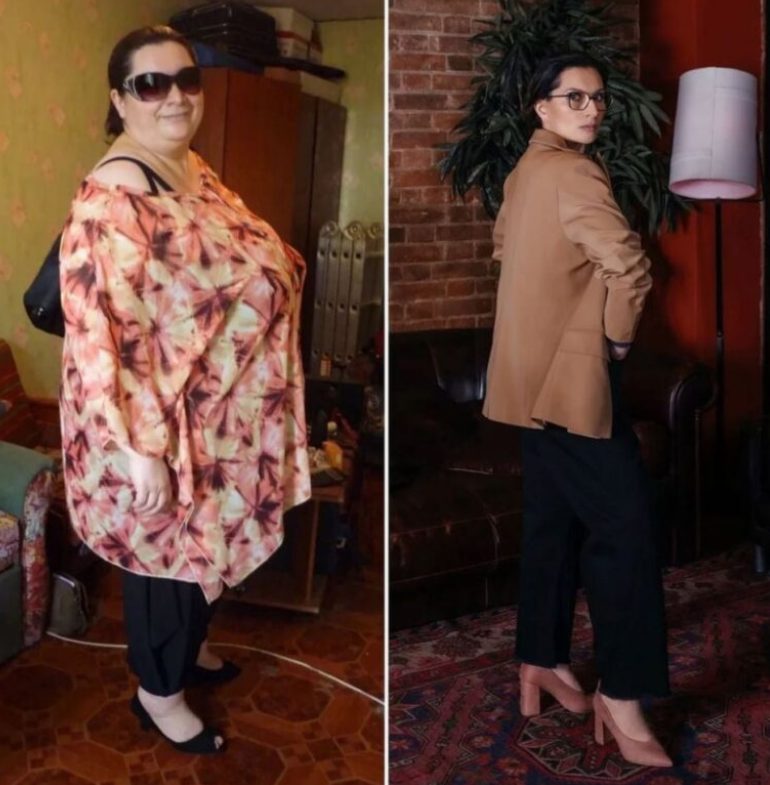 The woman was able to overcome everything! An incredible weight loss that will not leave anyone indifferent