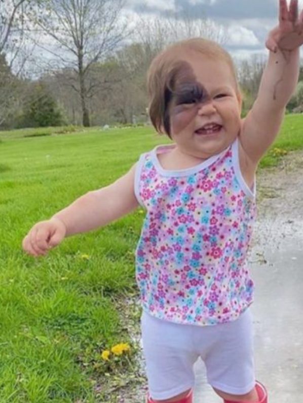 This wonderful youngster with a rare disease has a distinct beauty, and her amazing story inspires many!