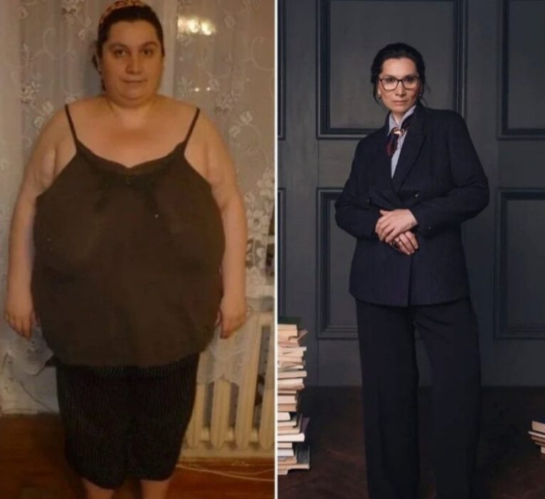 The woman was able to overcome everything! An incredible weight loss that will not leave anyone indifferent