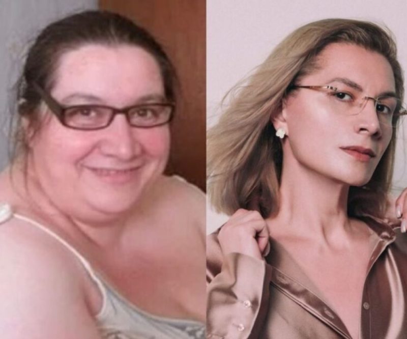 The woman was able to overcome everything! An incredible weight loss that will not leave anyone indifferent