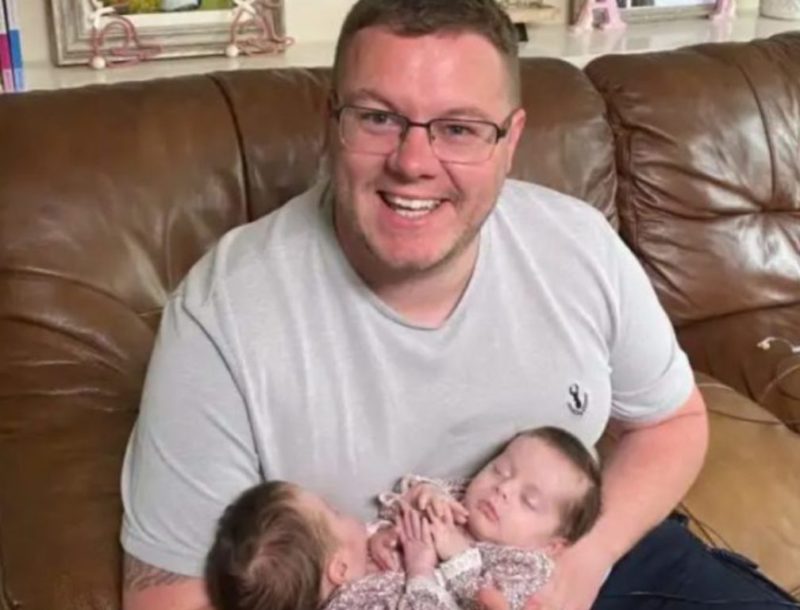 These babies are held together by flesh! Siamese twins are undergoing a difficult operation