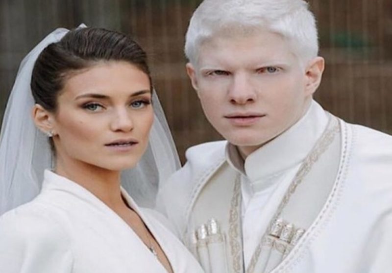 His eyes are sea-blue in colour! What appears to be the albino child of a model and a singer